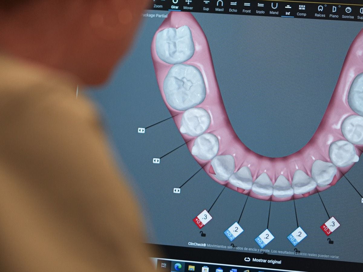 La Dra. Paz Salvador planifica en 3D los alineadores invisibles de un paciente